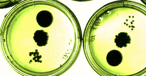 microbiological contamination